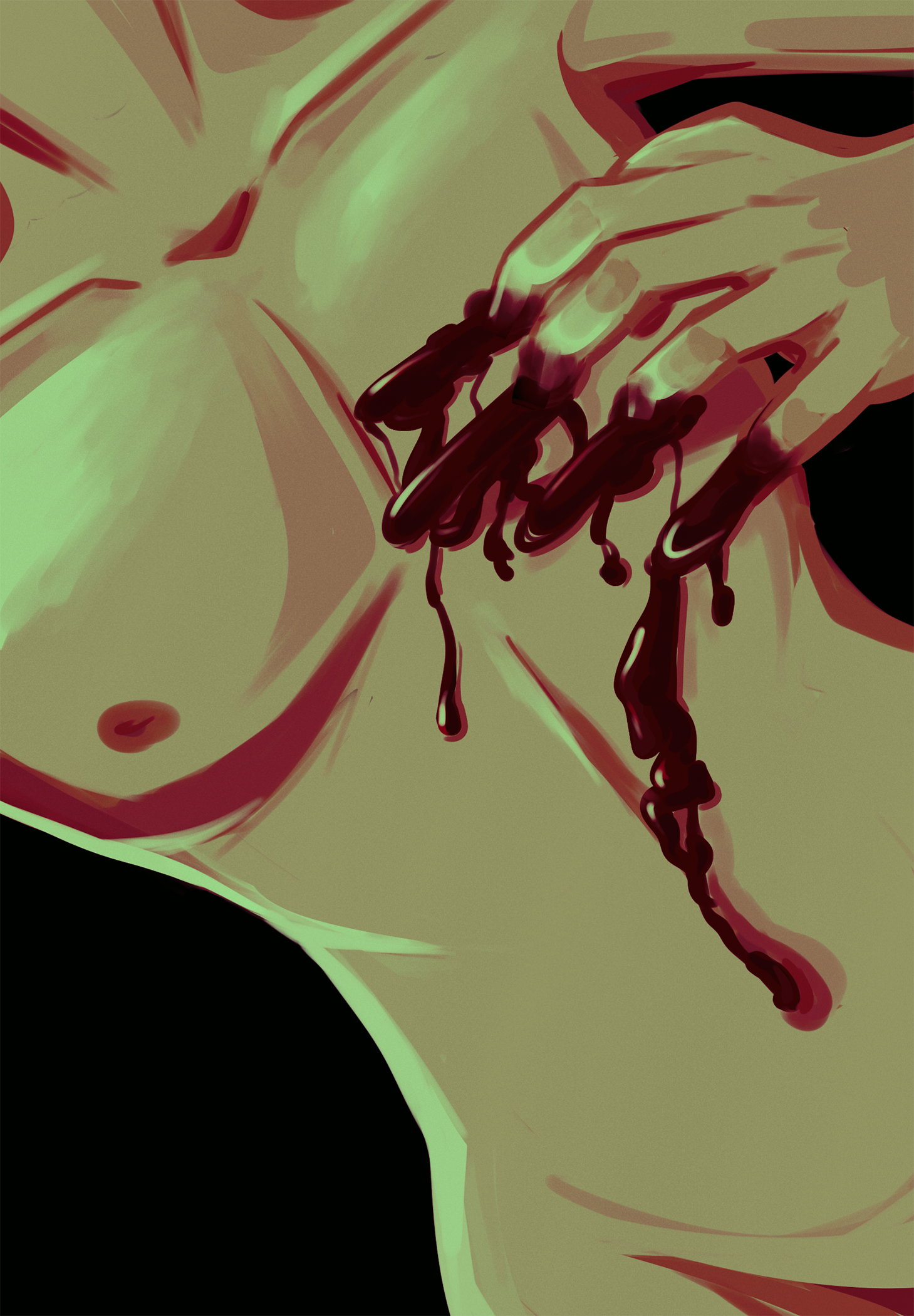 Scars